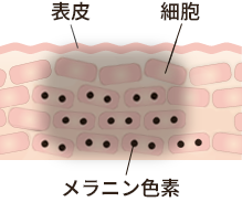 しみ・そばかすの原因